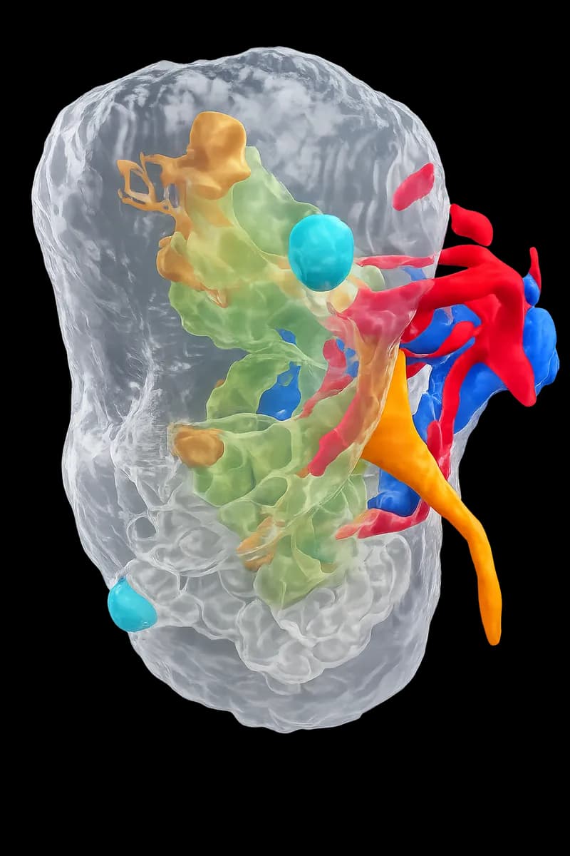 Rappresentazione 3D di un intervento di chirurgia renale